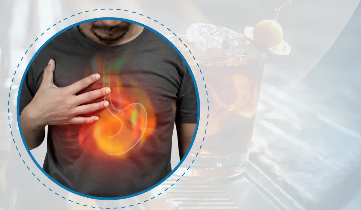 can alcohol cause acid reflux